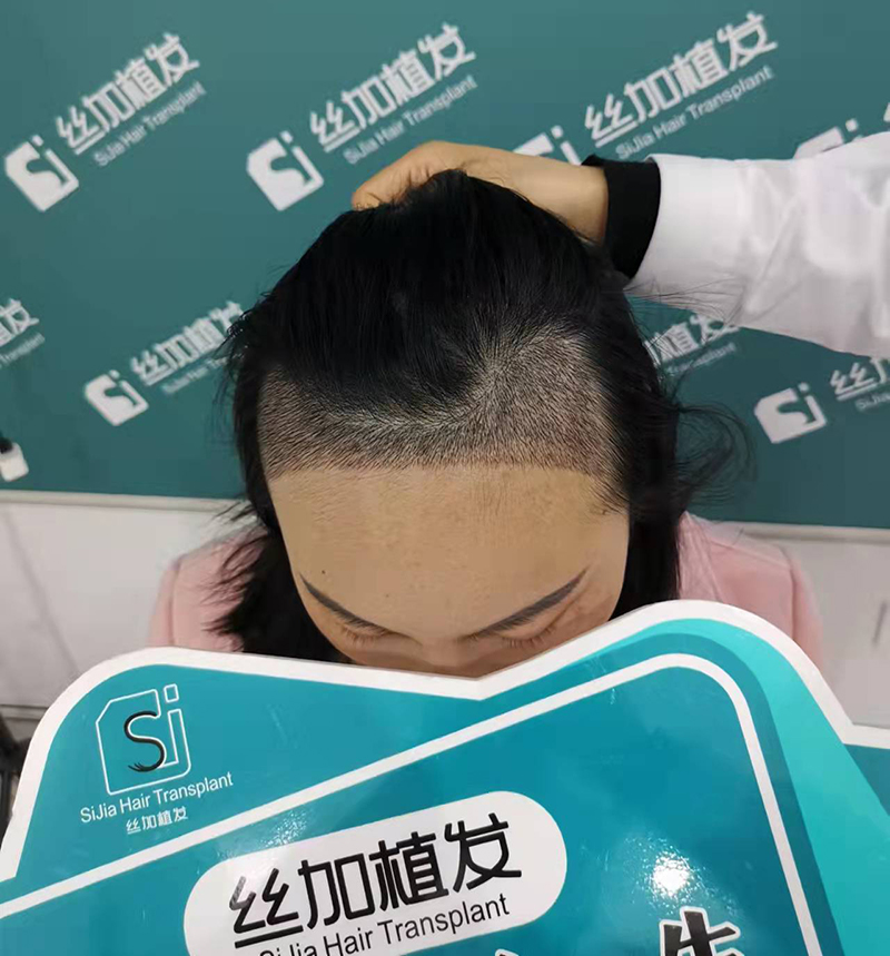 ä¸åŠ æ¤å‘4.jpg